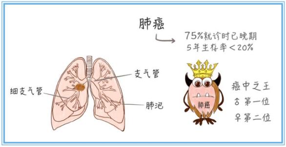 【第31个全国肿瘤防治宣传周健康科普】肺癌科普知识